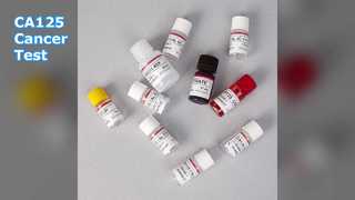 CA125 การทดสอบ ELISA เพื่อติดตามมะเร็ง