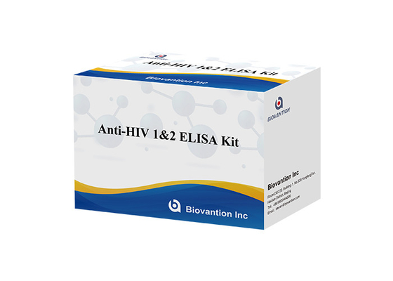 Human Anti HIV 1 &amp; 2 Elisa ชุดทดสอบสำหรับไวรัสภูมิคุ้มกันบกพร่องของมนุษย์