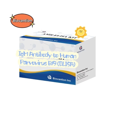 แอนติบอดีต่อพาร์วไวรัสมนุษย์ B19 IgM ELISA Test Kit