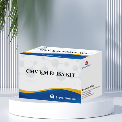 การทดสอบ ELISA คุณสมบัติ IgM ของแมคโรฟาจ IVD ชุดทดลอง