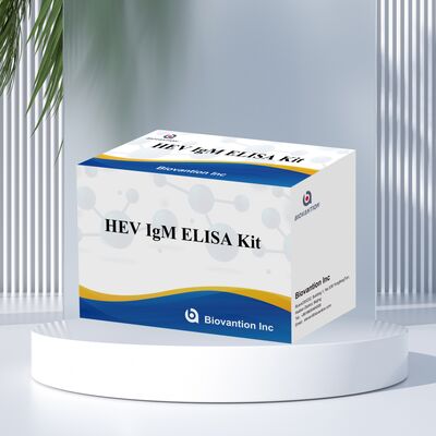 ชุดทดสอบ HEV IgM Elisa ความรู้สึกสูง ขนาด 96T และเวลาทดสอบ 2-3 ชั่วโมงสําหรับการวินิจฉัยที่แม่นยํา