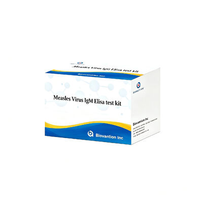 ชุดทดสอบไวรัสหัด IgM ELISA 96T การตรวจหาการติดเชื้อเฉียบพลันในระยะเริ่มแรก