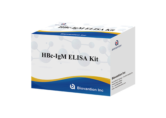 ISO13485 ชุดทดสอบ HBc IgM ไวรัสตับอักเสบบี Core Antibody Igm Test
