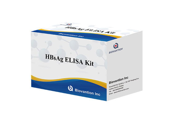 โรคติดเชื้อ HBsAg Elisa Kit Hepatitis B Surface Antigen Elisa Test