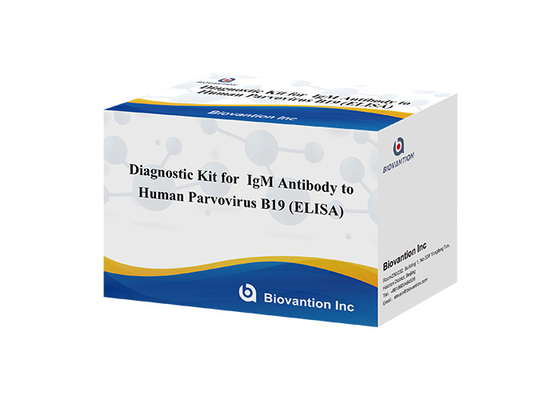 แอนติบอดีต่อพาร์วไวรัสมนุษย์ B19 IgM ELISA Test Kit
