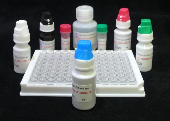 ISO13485 HIV Ab Ag Test ชุดตรวจ HIV รุ่นที่ 4 ชุด ELISA 60 นาที