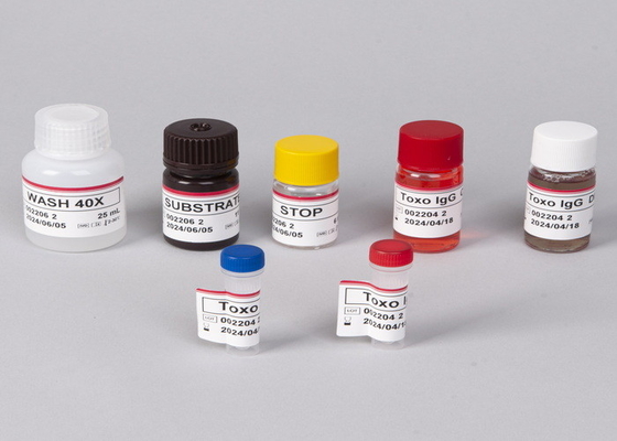 อานติบอดีไวรัสภูมิคุ้มกันของมนุษย์ (HIV) / Antigen ELISA Test Kit