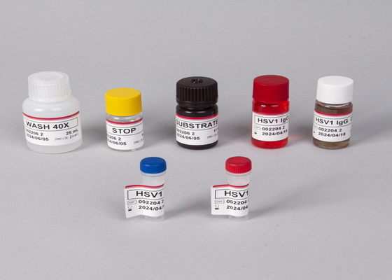 อานติบอดีไวรัสภูมิคุ้มกันของมนุษย์ (HIV) / Antigen ELISA Test Kit