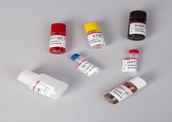 สําหรับห้องปฏิบัติการหรือโรงพยาบาล คิตทดสอบ Elisa ความแม่นยําสูง CA15-3