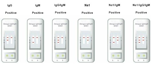 โรงพยาบาล ศูนย์การแพทย์ คิตทดสอบโรคแดงก้า IgG & IgM ที่มีความแม่นยําสูง