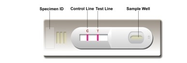 การทดสอบตัวเองในห้องปฏิบัติการหรือโรงพยาบาล ความแม่นยําสูง Leishmania Ab Combo Rapid Test