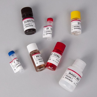 RV-G Elisa Test Kit สําหรับการวินิจฉัยประเภทตัวอย่างพลาสมา