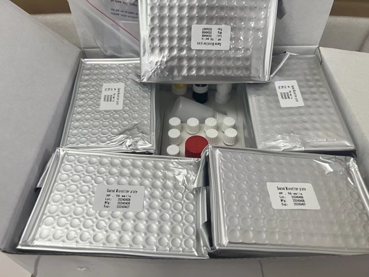 H Pylori ELISA Test Kit 480test/kit Elisa Screening Kit ผลการตรวจ