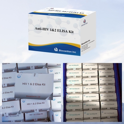 Biovantion Anti- HIV ELISA Test Kit อายุการใช้ 18 เดือน สําหรับการทดสอบ HIV-1 และ HIV-2