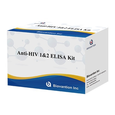 HIV Elisa Test Kit อายุการใช้งาน 18 เดือน Elisa Test ด้วยความรู้สึกและความเฉพาะสูง