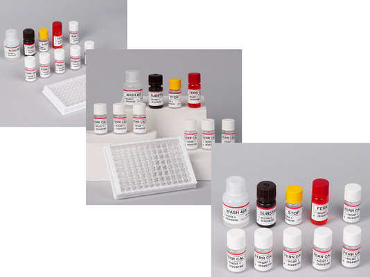ห้องปฏิบัติการหรือโรงพยาบาล ความละเอียดสูง Human ferritin FE ELISA TEST KIT