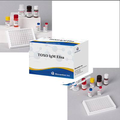 โรงพยาบาล ห้องปฏิบัติการ คลินิกใช้ Toxo IgM ELISA TEST KIT ความแม่นยําสูง