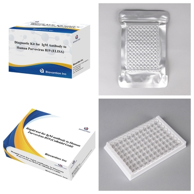 ชุดวินิจฉัยสําหรับมนุษย์ Parvovirus B19 IgM แอนติบอดี Elisa Test Kit With 96T