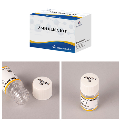 การอนุมัติ CE สําหรับการใช้ในมนุษย์ โรมออนมูลเลอร์ต้านทาน (AMH) เครื่องตรวจ ELISA กล่องตรวจเลือดหรือกรดเลือด 96T