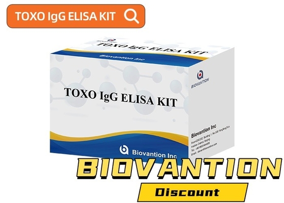 TOXO Ig G กล่องทดสอบ Elisa อ่อนโยนและเฉพาะสําหรับการติดตามโรค