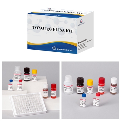 TOXO Ig G กล่องทดสอบ Elisa อ่อนโยนและเฉพาะสําหรับการติดตามโรค