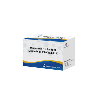 ชุดวินิจฉัยความรู้สึกสําหรับ CBV-IgG แอนติบอดีมนุษย์ตรวจสอบ Elisa Kits สําหรับการตรวจสอบชนิดตัวอย่างที่แม่นยํา