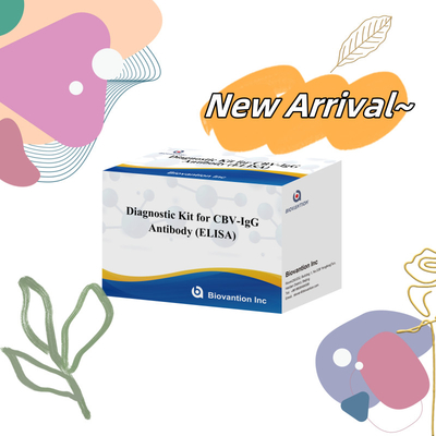 ชุดวินิจฉัยความรู้สึกสําหรับ CBV-IgG แอนติบอดีมนุษย์ตรวจสอบ Elisa Kits สําหรับการตรวจสอบชนิดตัวอย่างที่แม่นยํา