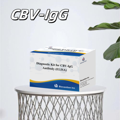ชุดวินิจฉัยความรู้สึกสําหรับ CBV-IgG แอนติบอดีมนุษย์ตรวจสอบ Elisa Kits สําหรับการตรวจสอบชนิดตัวอย่างที่แม่นยํา