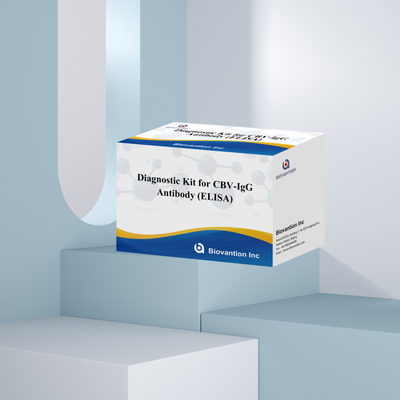 ชุดวินิจฉัยความรู้สึกสําหรับ CBV-IgG แอนติบอดีมนุษย์ตรวจสอบ Elisa Kits สําหรับการตรวจสอบชนิดตัวอย่างที่แม่นยํา