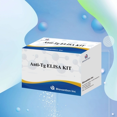 Elisa Diagnostic Kit For Human Antithyroglobulin Antibodies Anti-Tg สําหรับโรงพยาบาลและห้องทดลอง