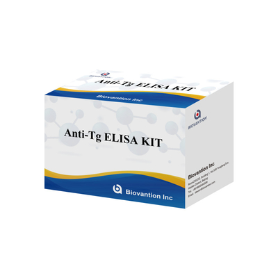 Elisa Diagnostic Kit For Human Antithyroglobulin Antibodies Anti-Tg สําหรับโรงพยาบาลและห้องทดลอง