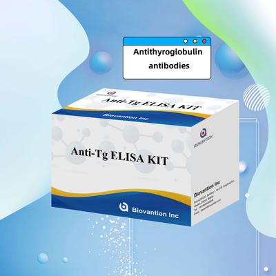Elisa Diagnostic Kit For Human Antithyroglobulin Antibodies Anti-Tg สําหรับโรงพยาบาลและห้องทดลอง
