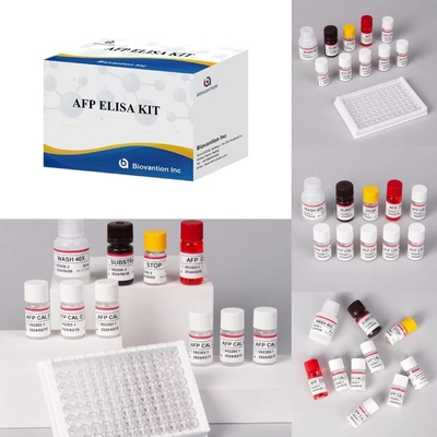 AFP Alpha Fetoprotein Elisa Test Kit ผลิตภัณฑ์ที่เชื่อมโยงกับเอ็นไซม์ เวลาขนส่งสั้น