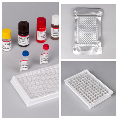 HIV Ab Ag Elisa Test Kits กับอายุการใช้งาน 18 เดือน และความรู้สึก / ความเฉพาะสูง