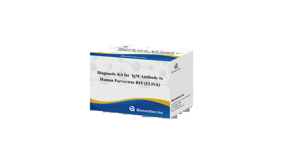 แอนติบอดีต่อพาร์วไวรัสมนุษย์ B19 IgM ELISA Test Kit
