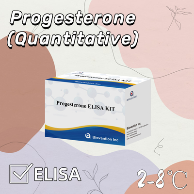 ความรู้สึก การทดสอบตัวประกอบการวินิจฉัย Elisa Progesterone ((Quantitative) สําหรับการใช้ในมนุษย์