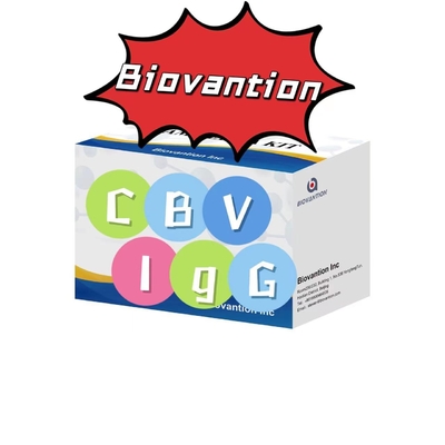 ชุดวินิจฉัยสําหรับแอนติบอดี CBV-IgG ชุดทดสอบ ELISA