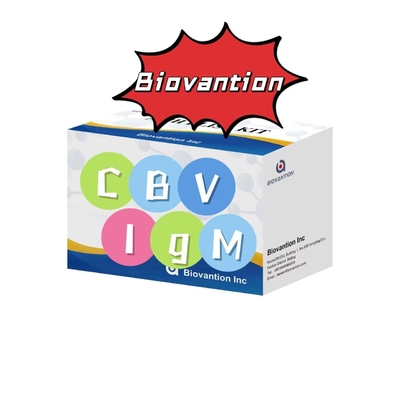 ชุดวินิจฉัยสําหรับ IgM แอนติบอดีต่อ CBV Elisa Test Kit 50μL Serum การวินิจฉัยทางการแพทย์