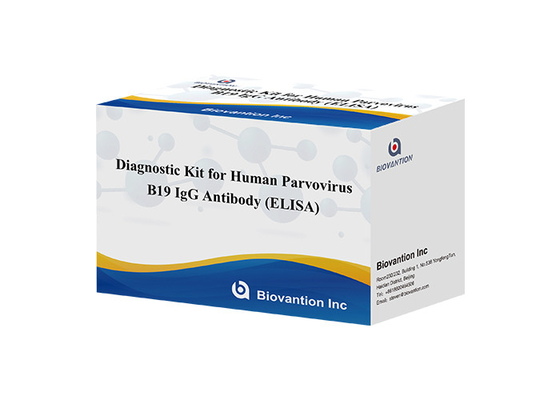 แอนติบอดีต่อพาร์วไวรัสมนุษย์ B19 IgM ELISA Test Kit