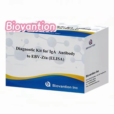 คิทวินิจฉัยสําหรับ IgA แอนติบอดีต่อ EBV-Zta ELISA TEST KIT คิทวินิจฉัยการสกัดภูมิคุ้มกัน