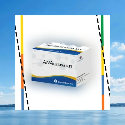 ชุดทดสอบ Anti ANA IgG ELISA การตรวจหาคุณภาพของแอนติบอดี IgG นิวเคลียร์