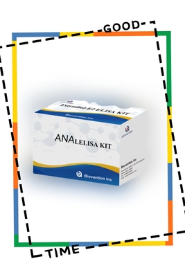 ชุดทดสอบ Anti ANA IgG ELISA การตรวจหาคุณภาพของแอนติบอดี IgG นิวเคลียร์
