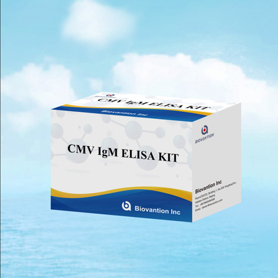 การทดสอบ ELISA คุณสมบัติ IgM ของแมคโรฟาจ IVD ชุดทดลอง