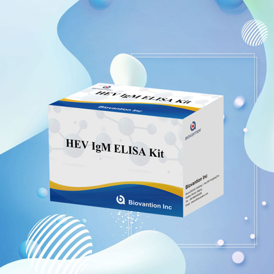 ชุดทดสอบ Elisa HEV-IgM ที่แม่นยําและมีความรู้สึก สําหรับการวินิจฉัยและการวิเคราะห์