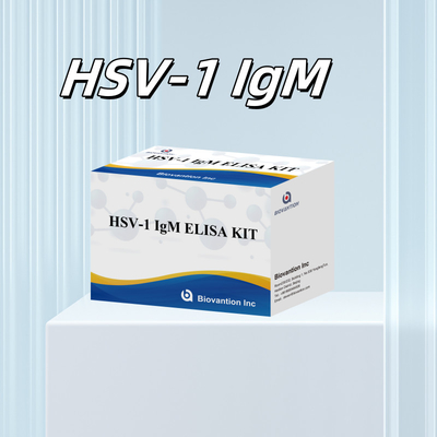 การวินิจฉัยทางการแพทย์ HSV-1 IgM Elisa Test Kit ด้วยอายุการใช้ 18 เดือน