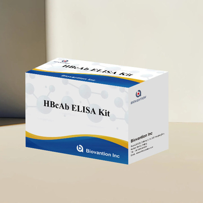 HBcAb ELISA Test Kit Assay Antibody Detection Kit คุณภาพ