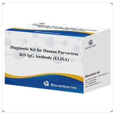 คิต ELISA B19 สําหรับมนุษย์ Parvovirus B19 IgM แอนติบอดี Elisa Test Kit With 96T