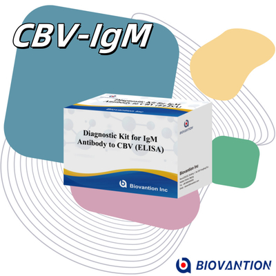คีบีวี igm ELISA KIT D หน่วยวินิจฉัยการวินิจฉัย 18 เดือน ช่วงเวลาใช้งาน