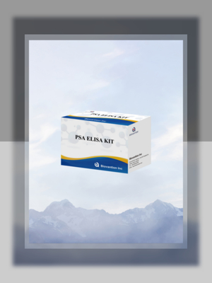 การทดสอบตัวตราเนื้องอก PSA ที่มีความรู้สึกสูง เพื่อการตรวจพบแอนติเจนเฉพาะต่อมลูกหมากในระยะแรก