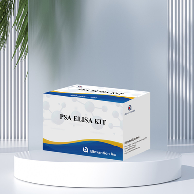 การทดสอบตัวตราเนื้องอก PSA ที่มีความรู้สึกสูง เพื่อการตรวจพบแอนติเจนเฉพาะต่อมลูกหมากในระยะแรก